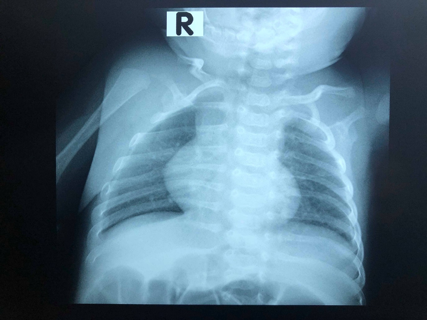 A picture containing X-ray film, necktie

Description automatically generated