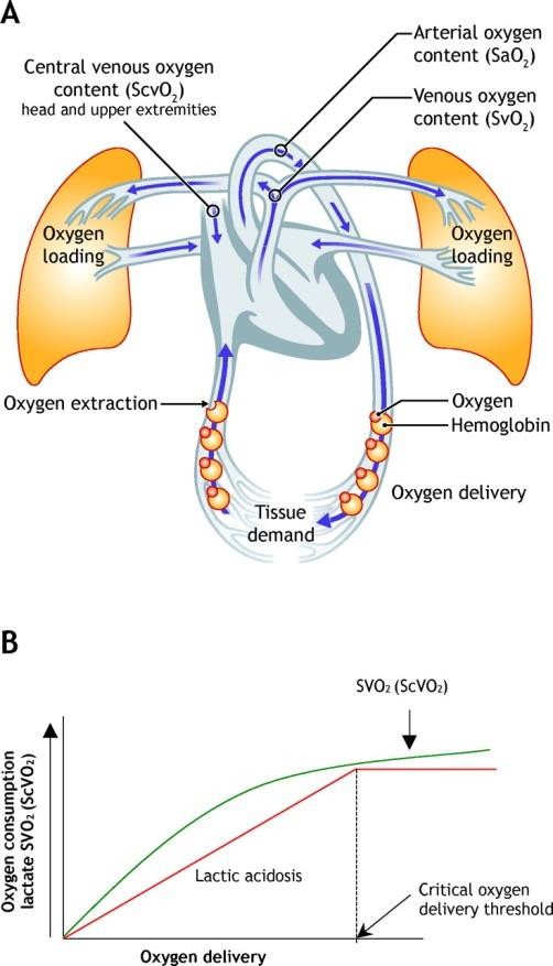 Why Does Sepsis Increased Svo2