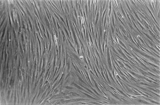 Image result for cultured endothelial cells