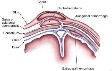 http://img.medscapestatic.com/pi/meds/ckb/68/25468tn.jpg