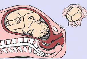 http://library.med.utah.edu/kw/human_reprod/mml/hrphysioL02.gif