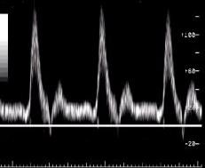 http://www.ob-ultrasound.net/project/figure2.jpg