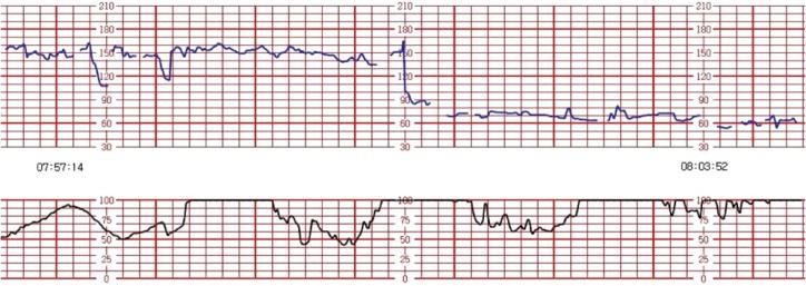 http://synapse.koreamed.org/ArticleImage/2021KJOG/kjog-54-300-g001-l.jpg