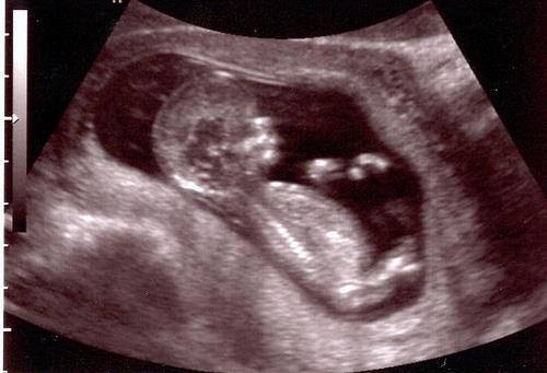 http://www.pregmed.org/wp-content/uploads/2014/04/12-Weeks-Pregnant-Ultrasound-Photo.jpg
